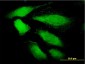 DDEF1 Antibody (monoclonal) (M01)